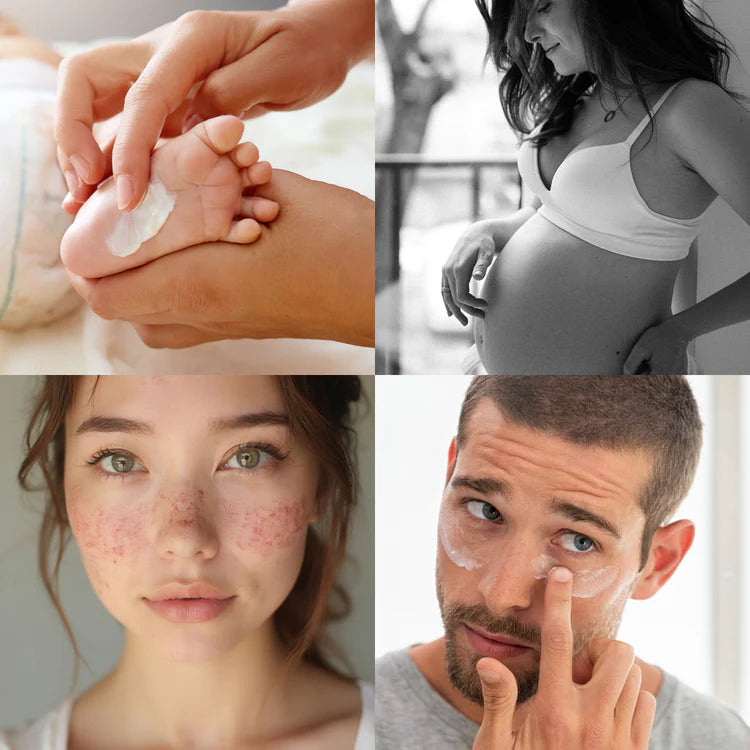 Collage of four images: a hand applying product to a foot, a pregnant woman, a close-up of a face with redness, and a man applying cream to his face.